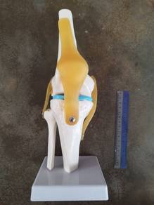 Orthopedic mold