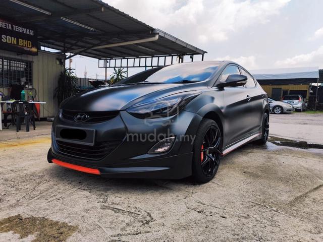 Hyundai ELANTRA 1.6 HIGH SPEC (A) MATTE BLACK - 2